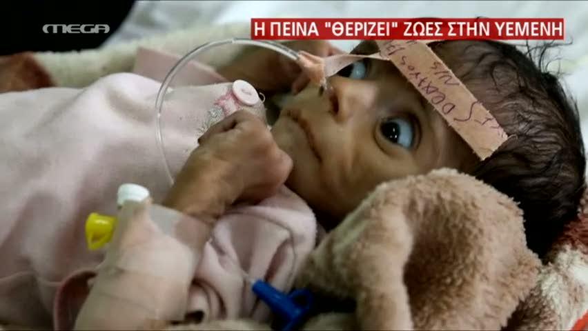 Η Υεμένη πεινά και η Δύση σιωπά! Του Άντρου Καραγιάννη Η Υεμένη πεινά και η Δύση σιωπά! Του Άντρου Καραγιάννη